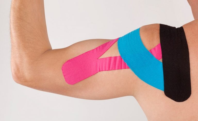 kinesiotaping